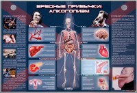 Электрифицированный стенд "Вредные привычки: алкоголизм" - fgospostavki.ru - Щёлково