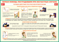 Таблица "Порядок действий при опасном кровотечении" (100х140 сантиметров, винил) - fgospostavki.ru - Щёлково