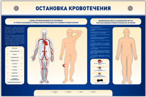 Электрифицированный стенд-тренажер "Остановка кровотечения" - fgospostavki.ru - Щёлково